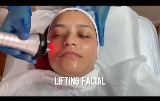lifting facial3