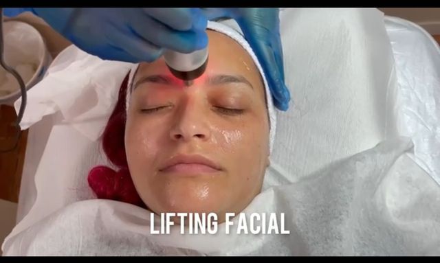 lifting facial