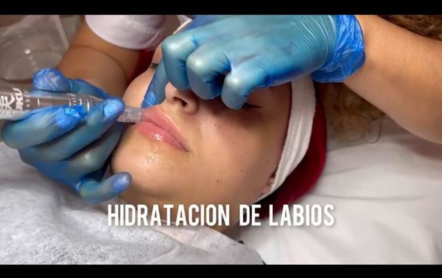 hidratacion labios3